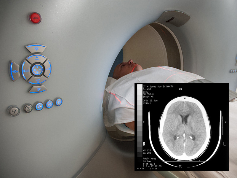 CT head scan / Image © ASRT