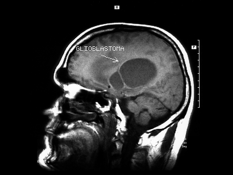 Magnetic resonance image of head / Image © ASRT